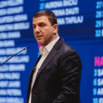 QKUK pajiset me sistemin “Scalp Cooling”, risi në rajon për zvogëlimin e rënies së flokëve për pacientët me kancer