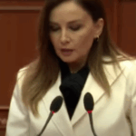 Nga ankthi te rënia e flokëve, zbuloni shenjat që tregojnë se trupit juaj ka nevojë për Vitaminë D